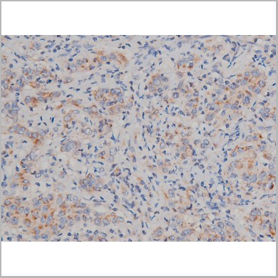 product-image-AAA31040_IHC5.jpg