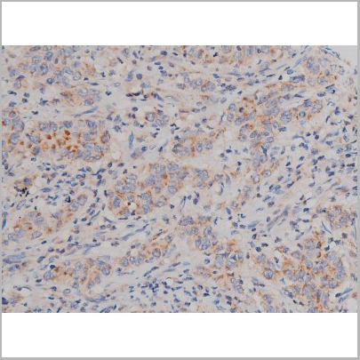 product-image-AAA31040_IHC6.jpg