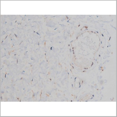 product-image-AAA31040_IHC7.jpg