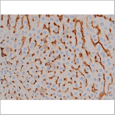 product-image-AAA31040_IHC8.jpg