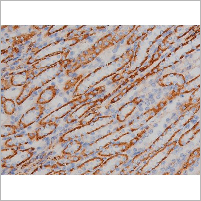 product-image-AAA31040_IHC9.jpg