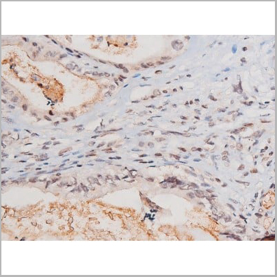 product-image-AAA31041_IHC11.jpg