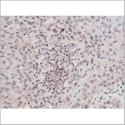 product-image-AAA31041_IHC13.jpg