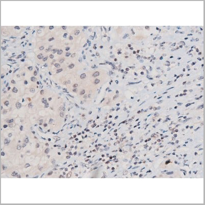 product-image-AAA31041_IHC15.jpg