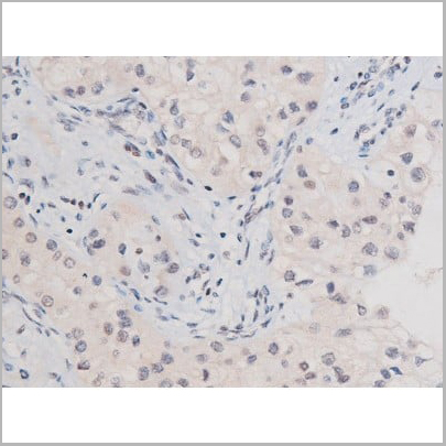 product-image-AAA31041_IHC16.jpg