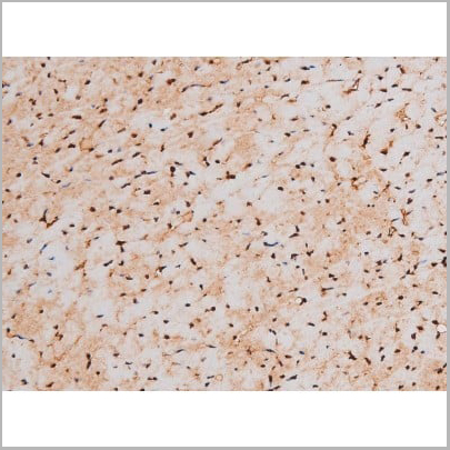 product-image-AAA31041_IHC17.jpg