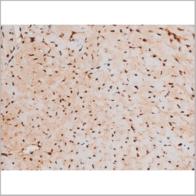 product-image-AAA31041_IHC18.jpg