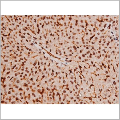 product-image-AAA31041_IHC19.jpg