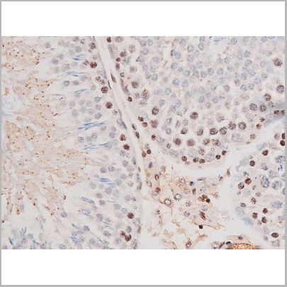 product-image-AAA31041_IHC3.jpg