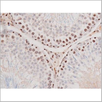 product-image-AAA31041_IHC4.jpg