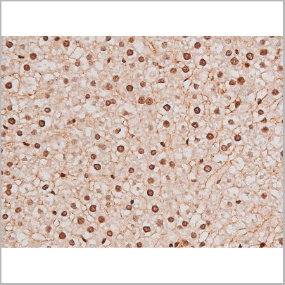 product-image-AAA31041_IHC5.jpg