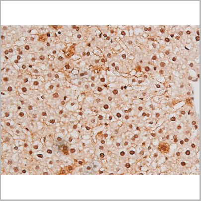 product-image-AAA31041_IHC6.jpg