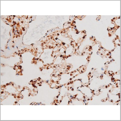 product-image-AAA31041_IHC7.jpg