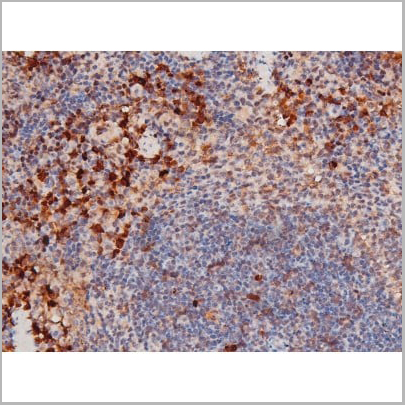 product-image-AAA31042_IHC11.jpg