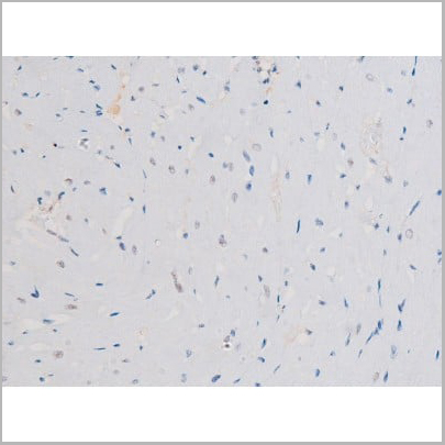 product-image-AAA31042_IHC12.jpg