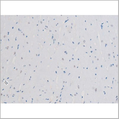 product-image-AAA31042_IHC13.jpg