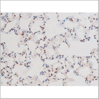 product-image-AAA31042_IHC14.jpg