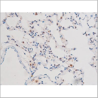 product-image-AAA31042_IHC15.jpg