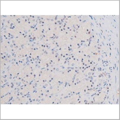 product-image-AAA31042_IHC16.jpg