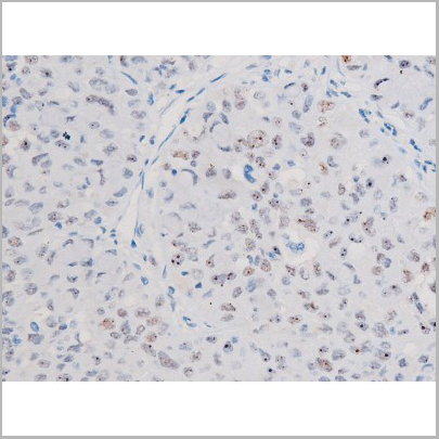product-image-AAA31042_IHC2.jpg