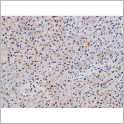 product-image-AAA31042_IHC3.jpg