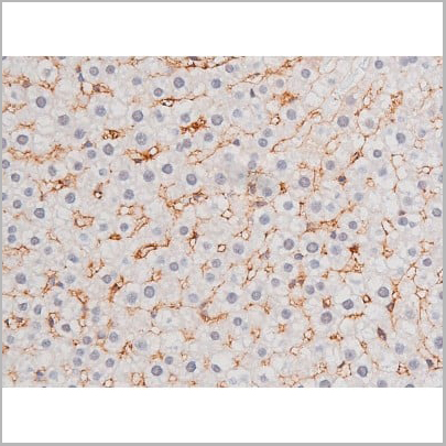 product-image-AAA31043_IHC11.jpg