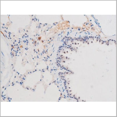 product-image-AAA31043_IHC12.jpg
