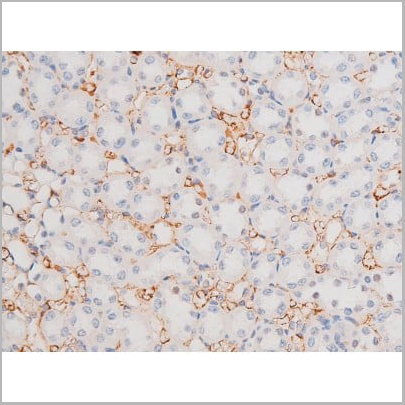 product-image-AAA31043_IHC13.jpg