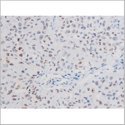product-image-AAA31043_IHC4.jpg