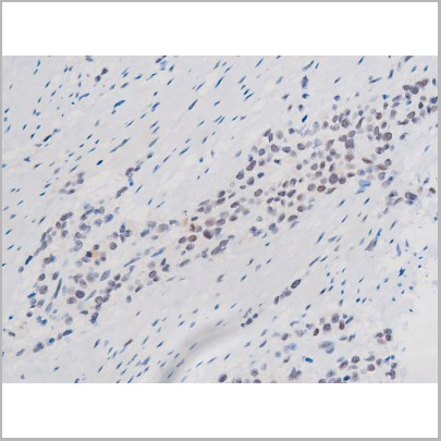product-image-AAA31043_IHC5.jpg