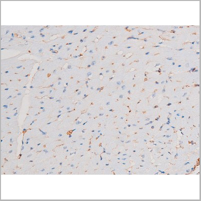 product-image-AAA31043_IHC7.jpg