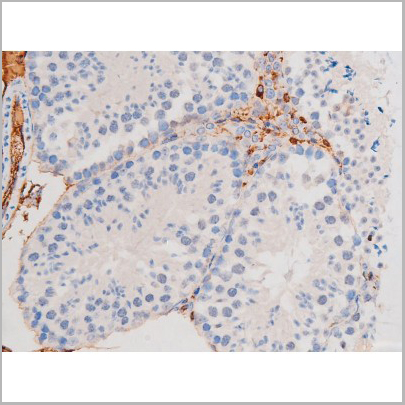 product-image-AAA31043_IHC8.jpg