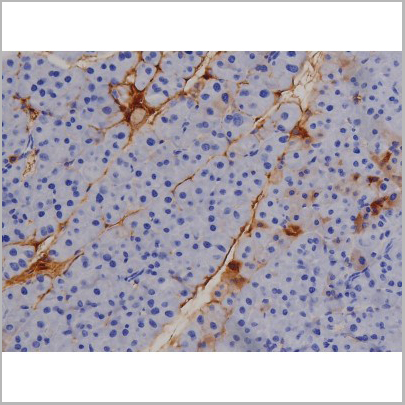 product-image-AAA31044_IHC4.jpg