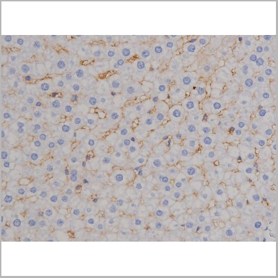 product-image-AAA31044_IHC5.jpg