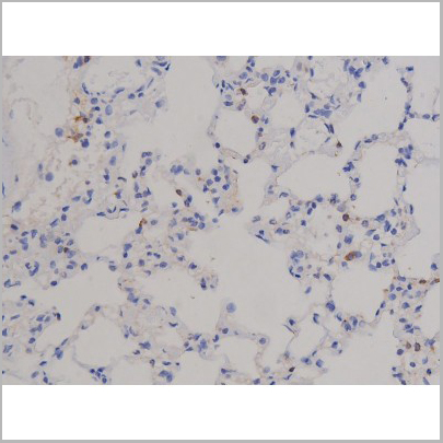 product-image-AAA31044_IHC6.jpg