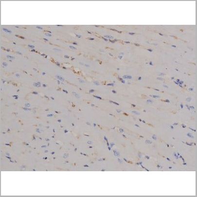 product-image-AAA31045_IHC2.jpg