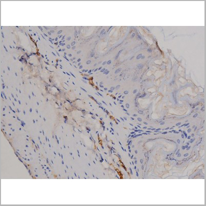product-image-AAA31045_IHC3.jpg