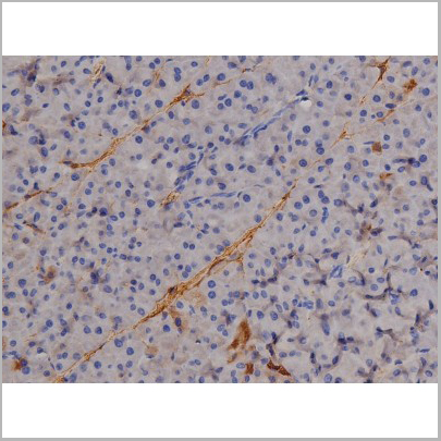 product-image-AAA31045_IHC4.jpg