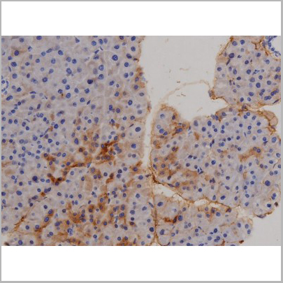 product-image-AAA31045_IHC5.jpg
