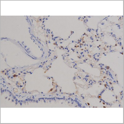 product-image-AAA31045_IHC6.jpg