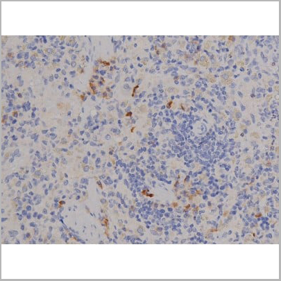 product-image-AAA31045_IHC8.jpg