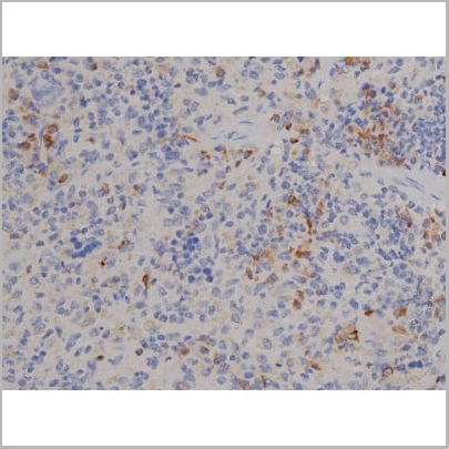 product-image-AAA31045_IHC9.jpg