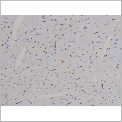 product-image-AAA31046_IHC2.jpg