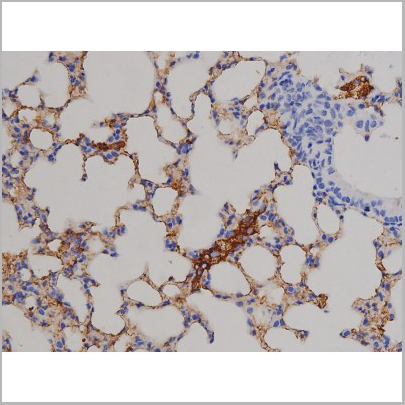 product-image-AAA31046_IHC3.jpg