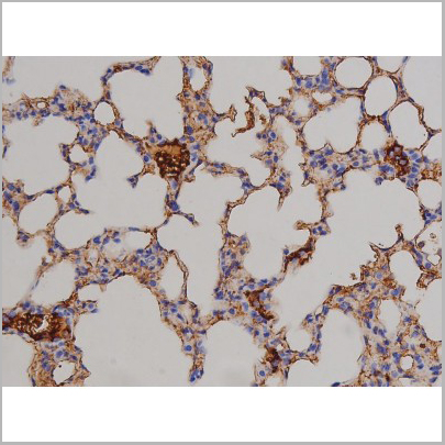 product-image-AAA31046_IHC4.jpg