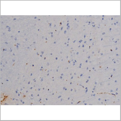 product-image-AAA31046_IHC5.jpg