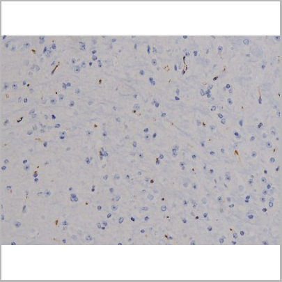 product-image-AAA31046_IHC6.jpg