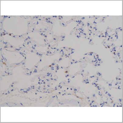 product-image-AAA31046_IHC7.jpg