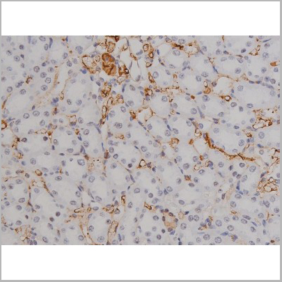 product-image-AAA31046_IHC9.jpg