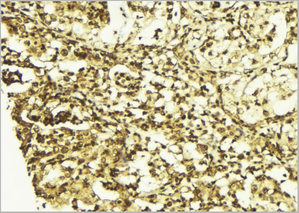product-image-AAA31047_IHC3.jpg